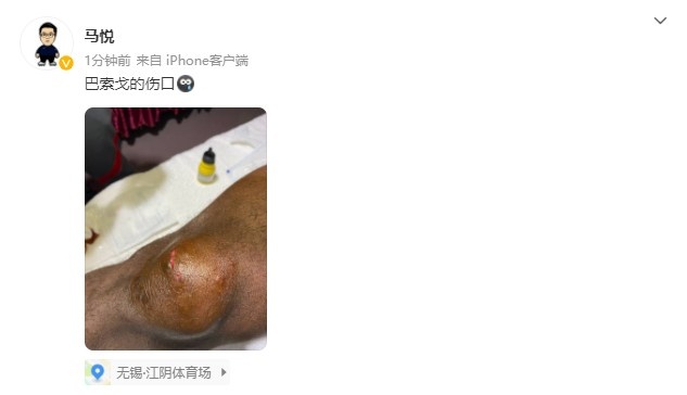 申花新闻官沙巴索戈受伤部位:膝盖肿胀 伤口明显