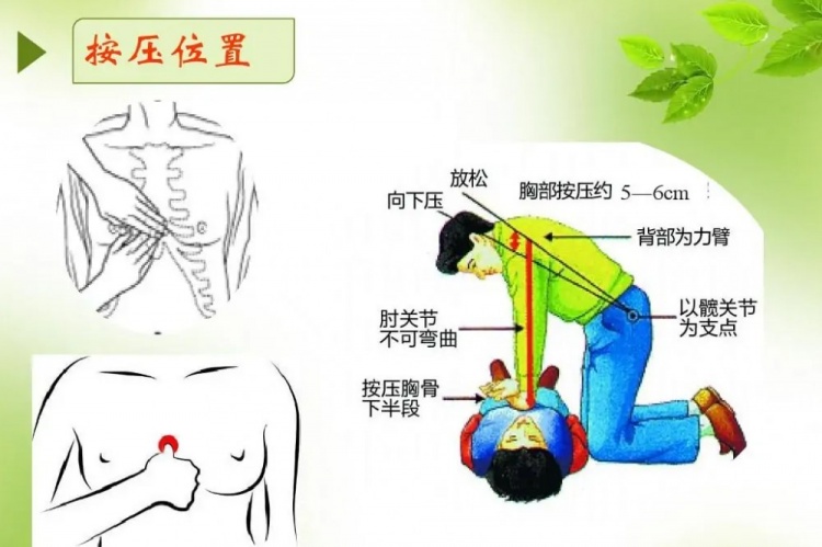 切记！心脏复苏手术科学:抢救心脏骤停患者4分钟的黄金