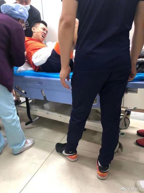 放松训练时腿部严重受伤 记者:张驰在训练中受伤了