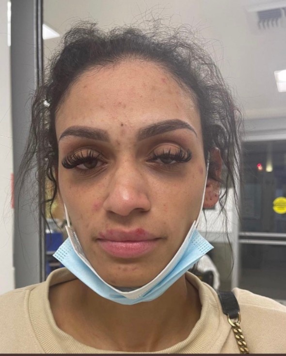 小桥妻子控诉：遭遇鼻子骨折手腕撕裂等伤 我不能再被迫保持沉默
