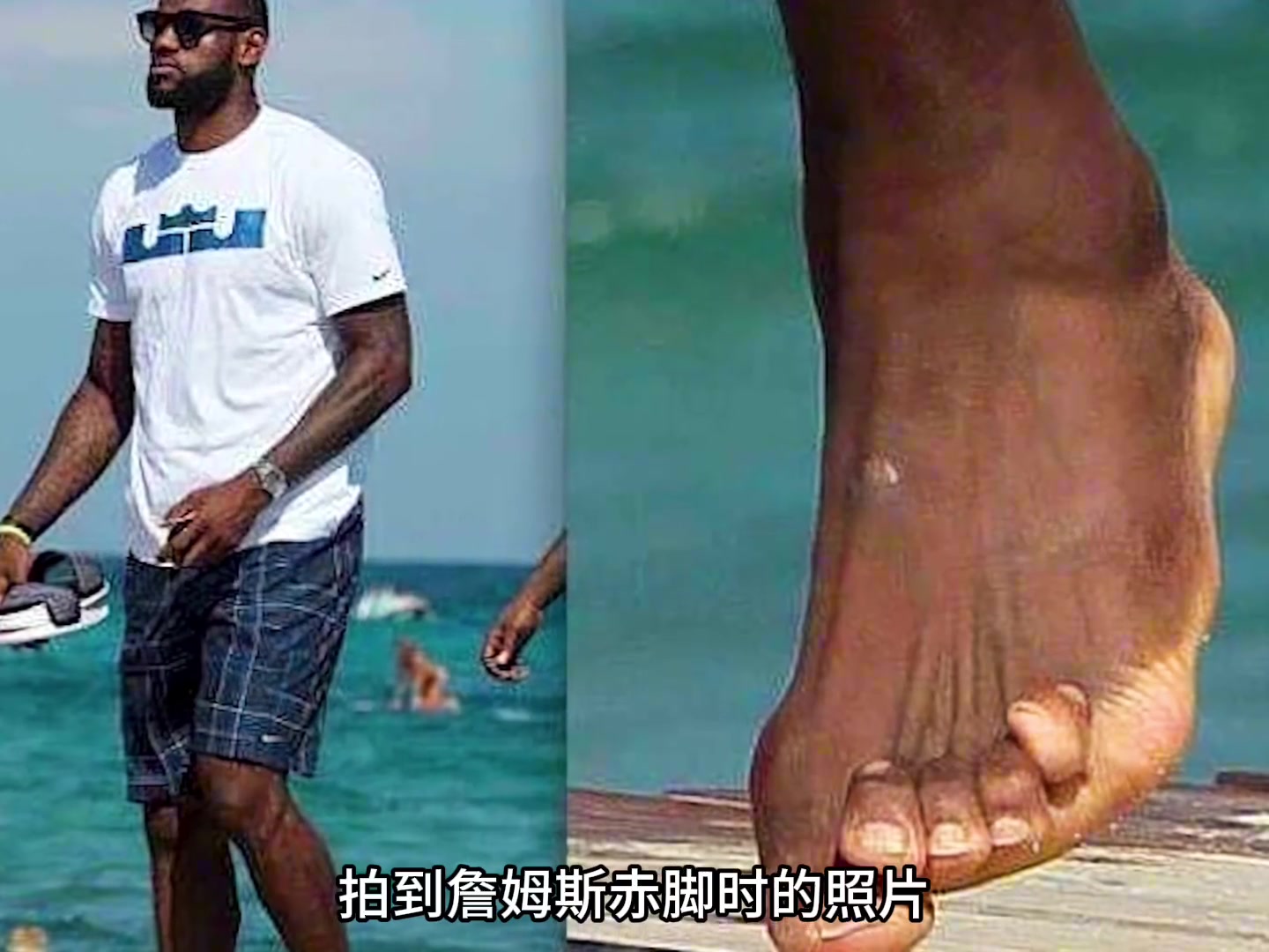 在NBA打球对身体透支有多大？詹姆斯和科比的手脚看着让人心疼！