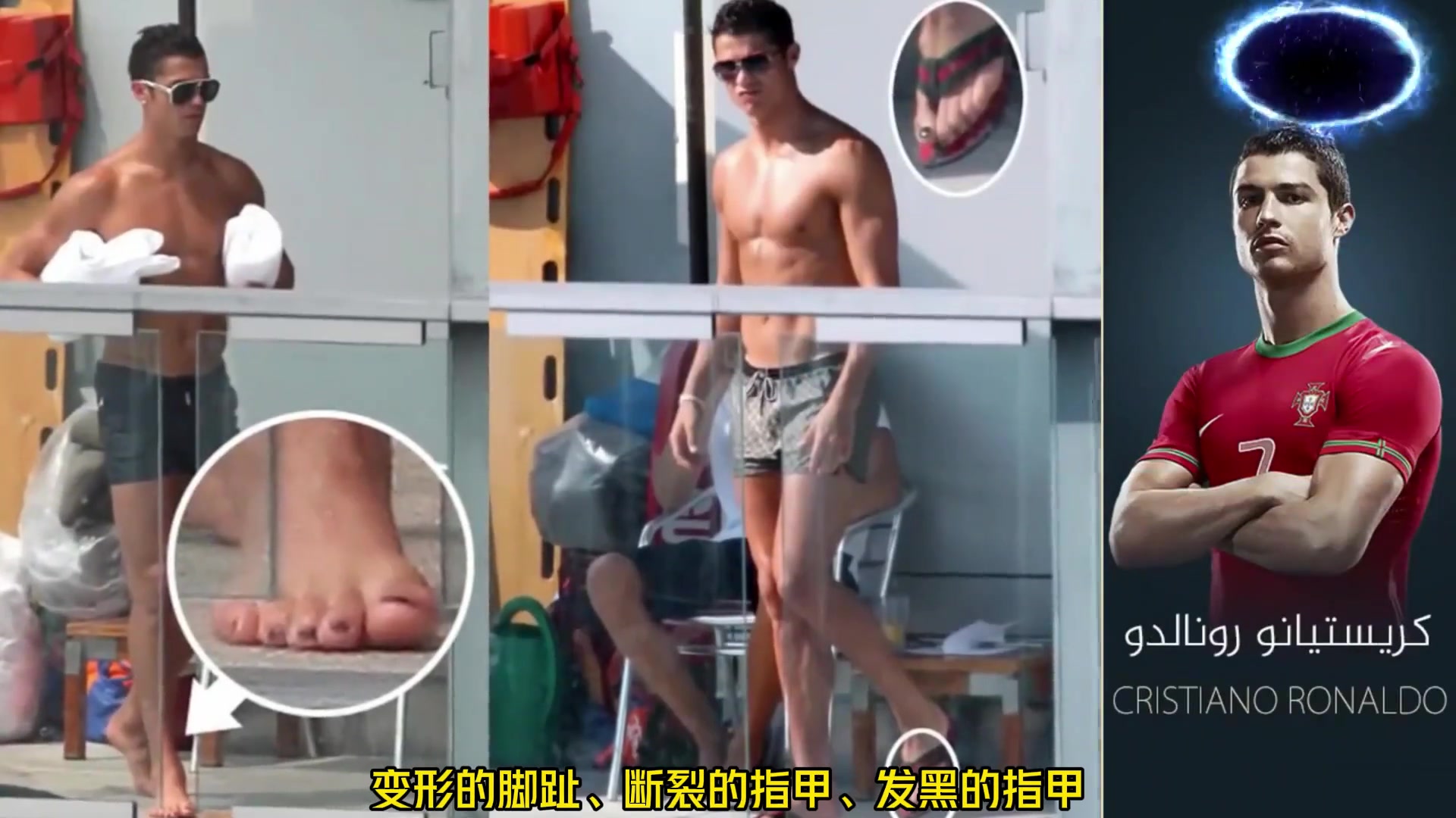 为什么足球运动员的脚看起来都很可怕？