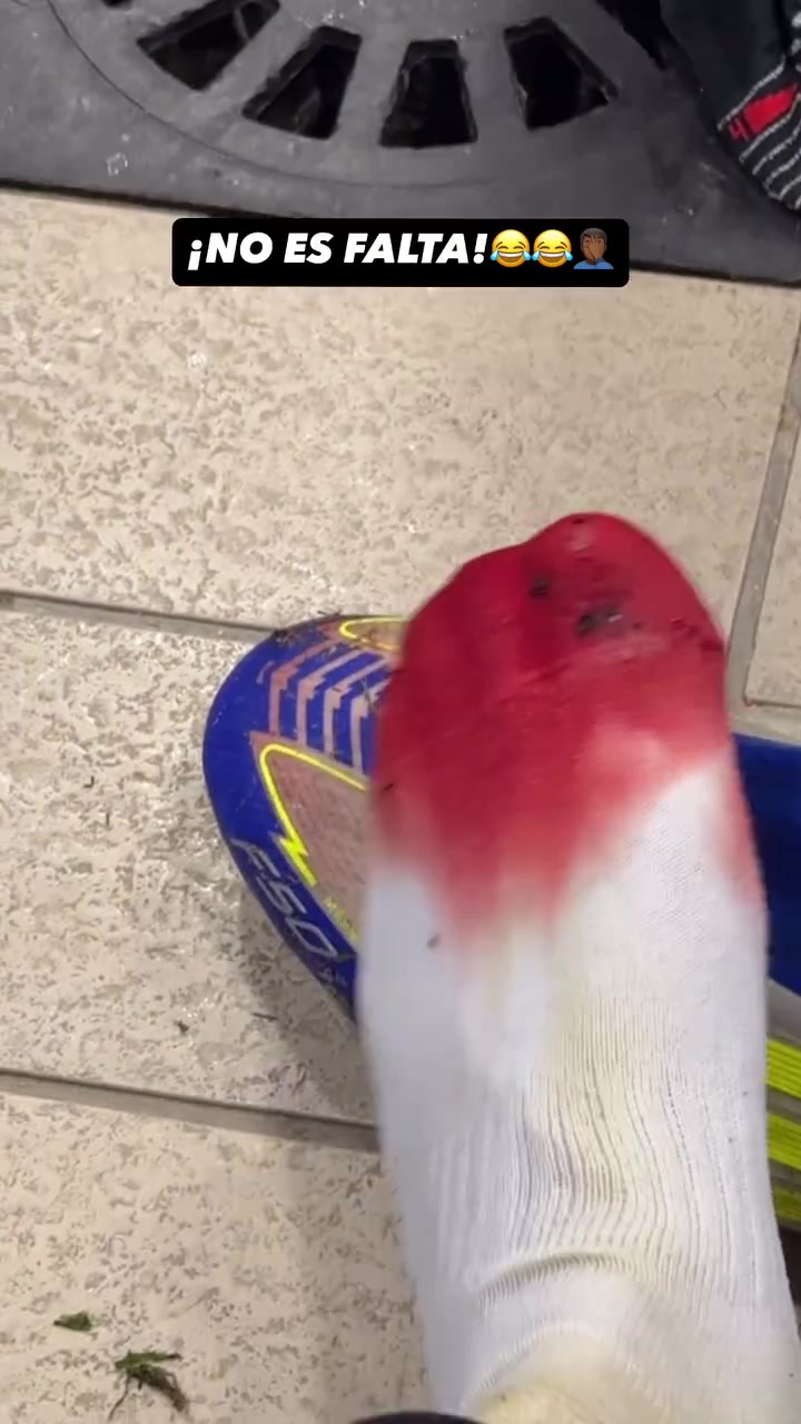 亚马尔社媒晒鲜血染红袜子视频：没有犯规