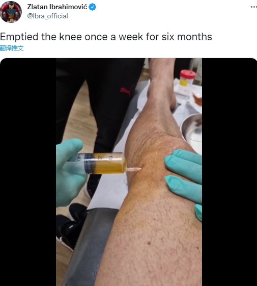 慎入！伊布晒视频：过去6个月，每周都要这么抽1次膝盖积液