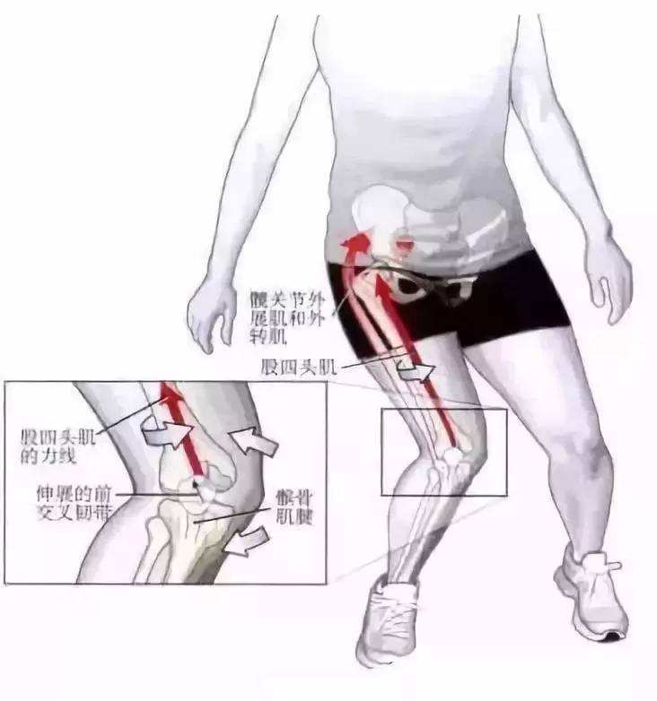髌腱炎「髌腱炎自愈的最佳办法」