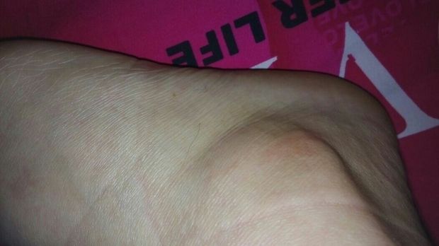 右脚「右脚大拇指麻木是什么原因」