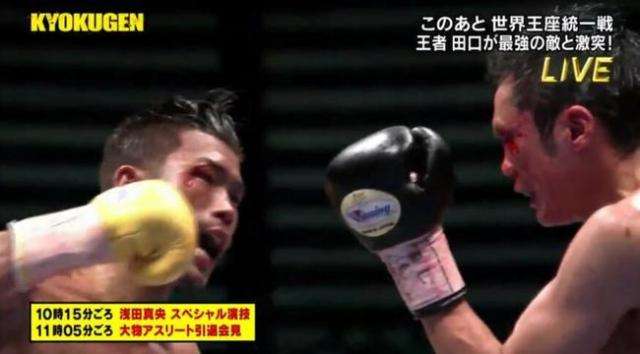 邹市明vs木村翔，邹市明vs木村翔全程